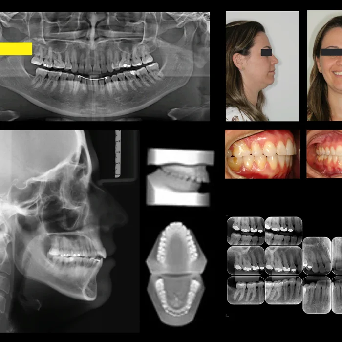 documentacao ortodontica + radiologia odontologica + sao paulo + uniradiographic