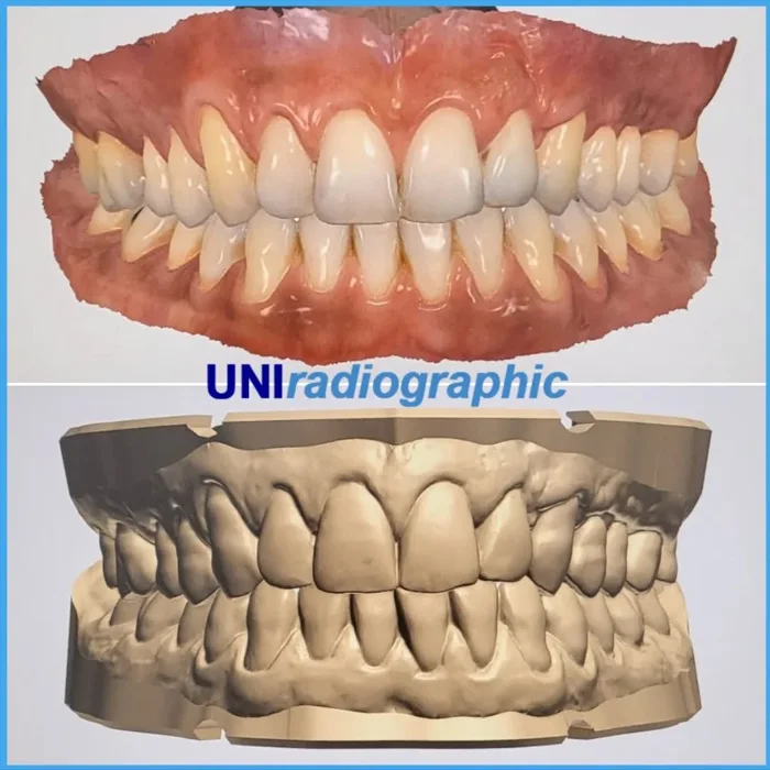 escaneamento intraoral + radiologia odontologica + sao paulo + uniradiographic