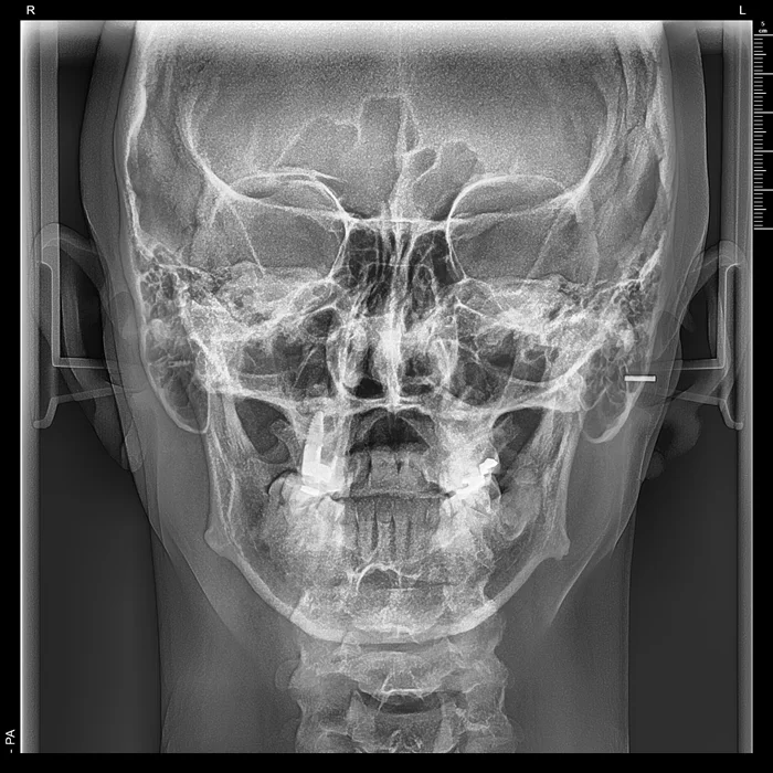 telerradiografia frontal + radiologia odontologica + sao paulo + uniradiographic