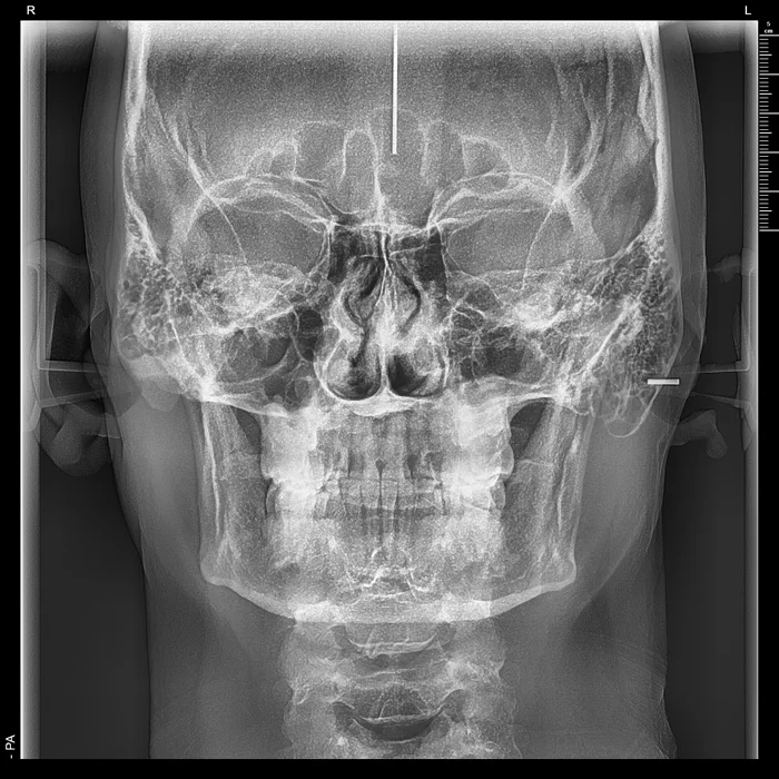 telerradiografia frontal + radiologia odontologica + sao paulo + uniradiographic