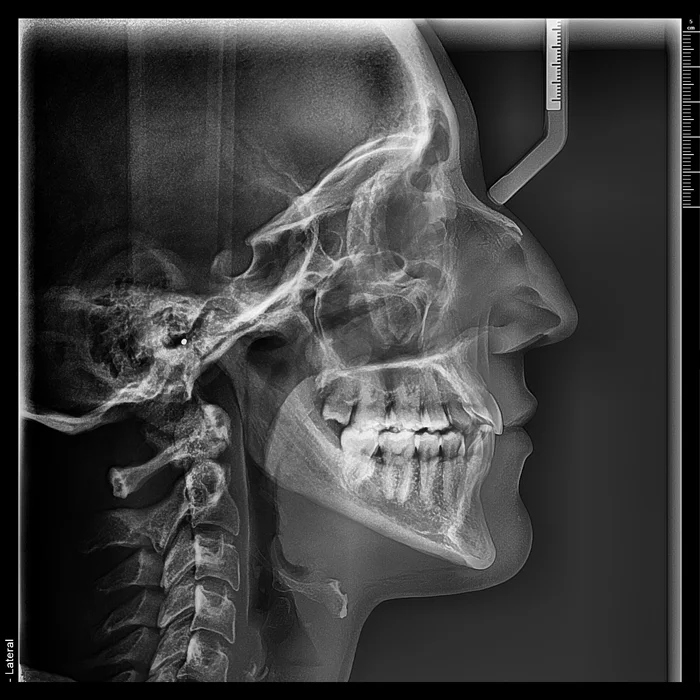telerradiografia lateral + radiologia odontologica + sao paulo + uniradiographic