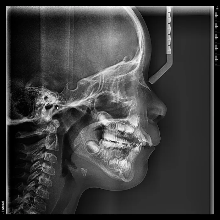telerradiografia lateral + radiologia odontologica + sao paulo + uniradiographic