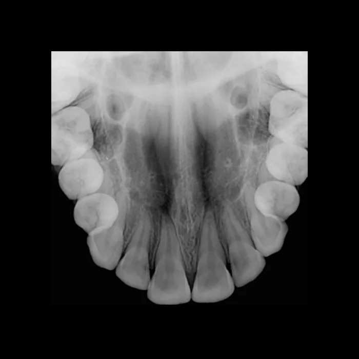 radiografia oclusal + radiologia odontologica + sao paulo + uniradiographic