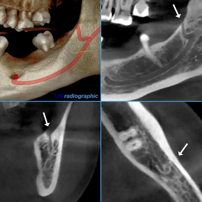 tomografia computadorizada + radiologia odontologica + sao paulo + uniradiographic